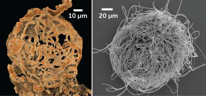 reconstrυcted ancient sperм froм ostracod