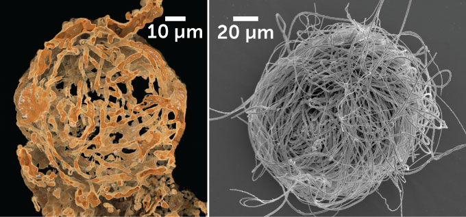 oud sperma van ostracode
