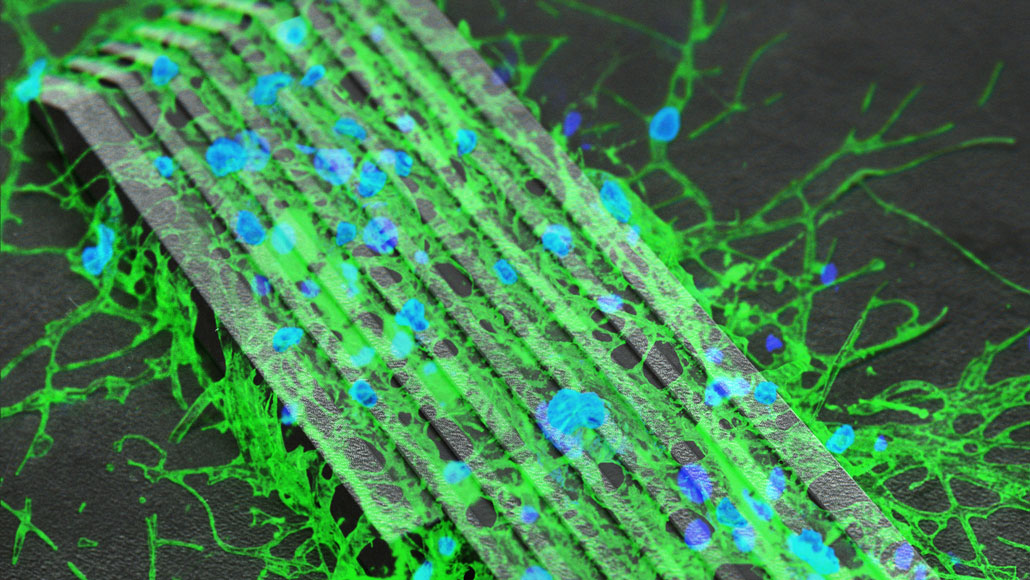 Nerve cells (colored blue and green in this microscope image) grow along thin grooves of a microrobot that scientists control with magnetic fields. Ti