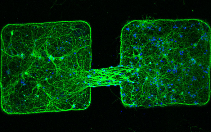 a tiny robot connecting nerve cell clusters