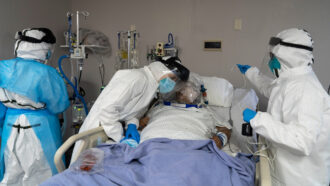COVID-19 patient in the ICU