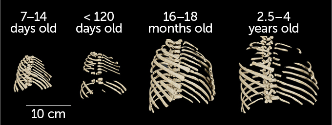 Neandertal child ribcages