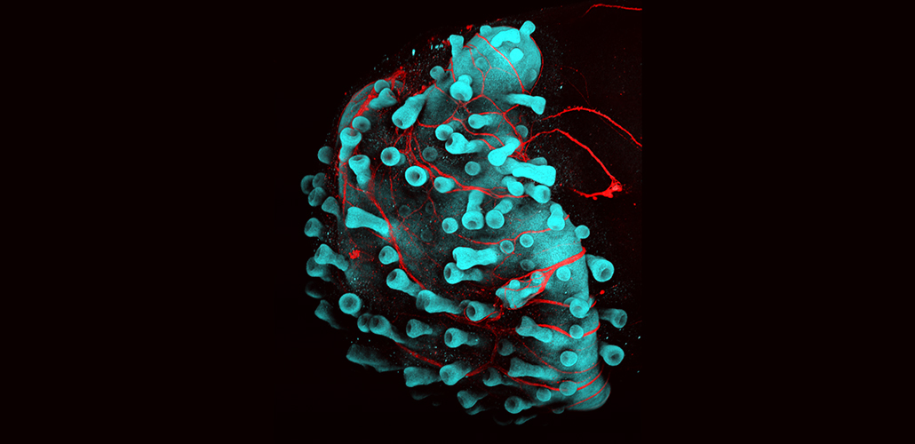 skin organoid