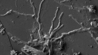 preserved nerve cells