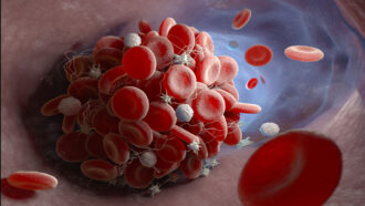 illustration of blood clot