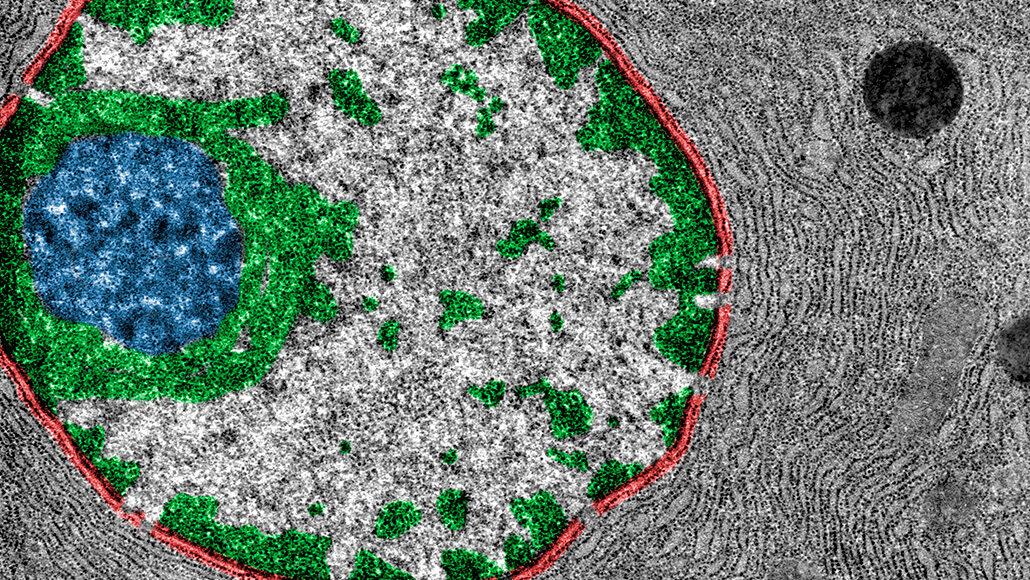 heterochromatin