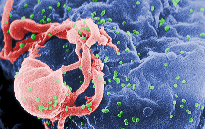 HIV emerging from a human cell