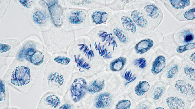 microscope image of plant cells