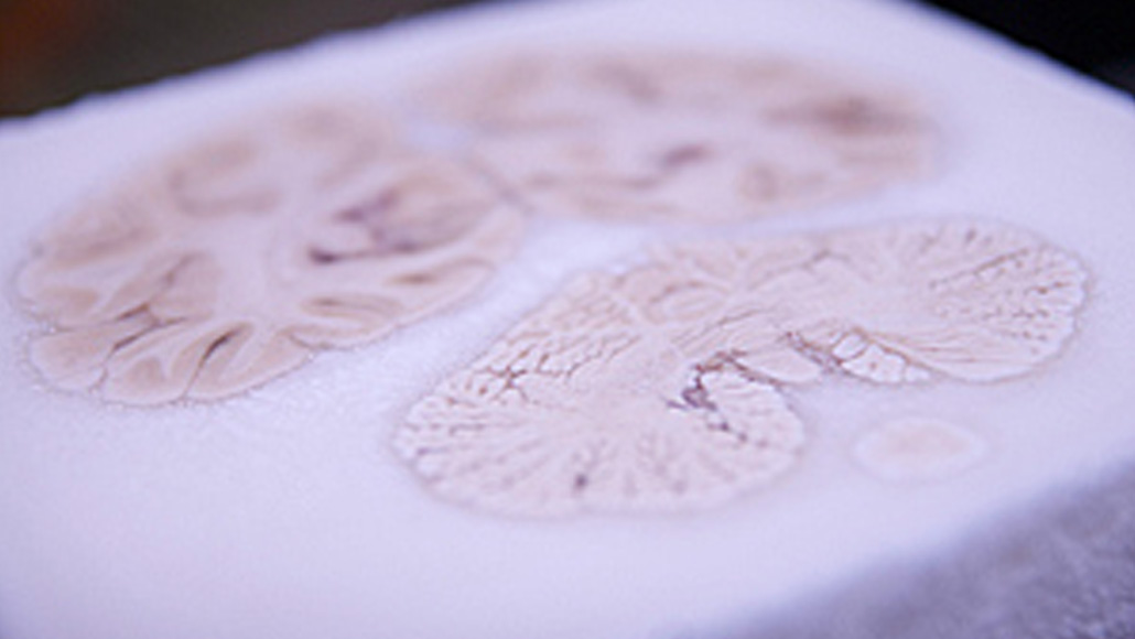 hippocampus location