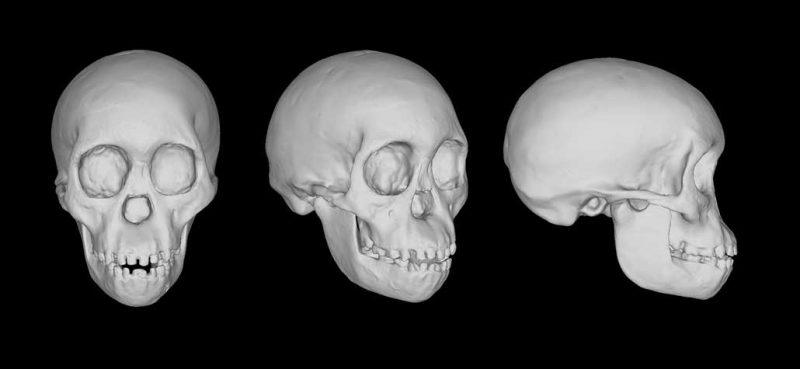 three views of a scan of a skull
