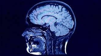 scan of human brain