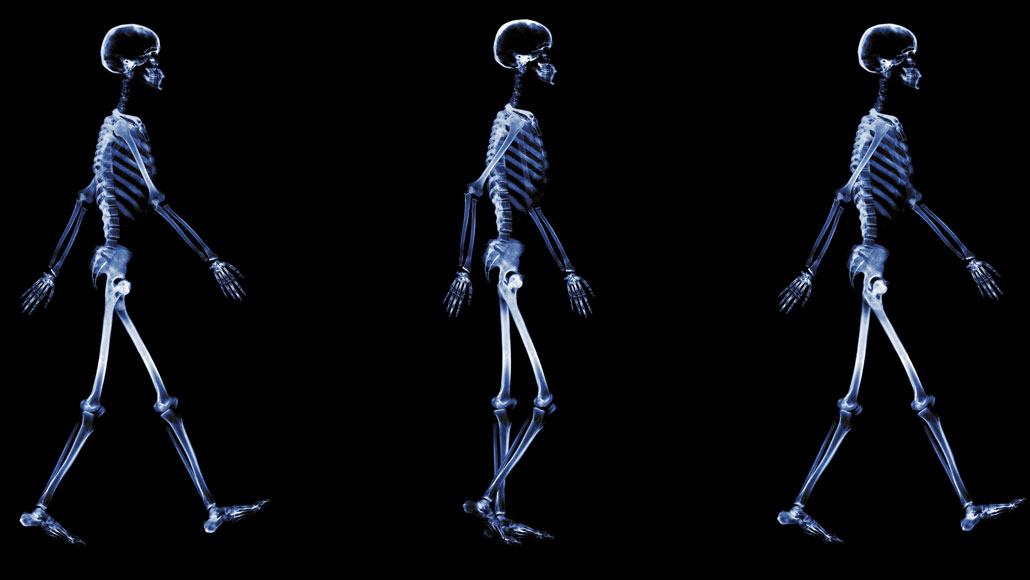 Series of walking skeletons