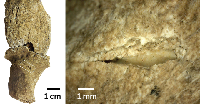 split picture of an overview of a bone (left) and a close up of the puncture (right)