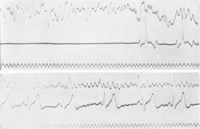 Diagram of brain activity