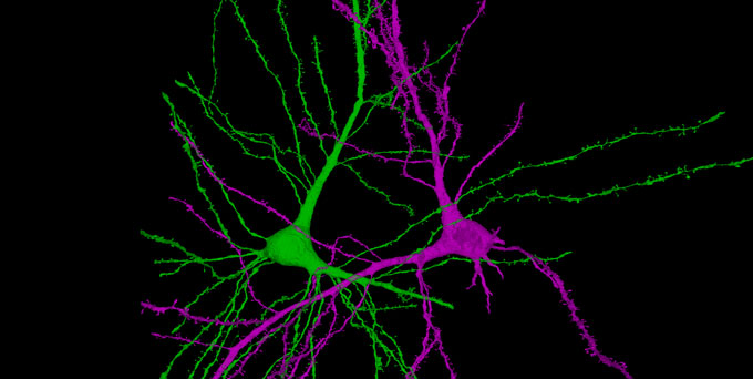 black background with green and purple nerve cells with lots of long tendrils