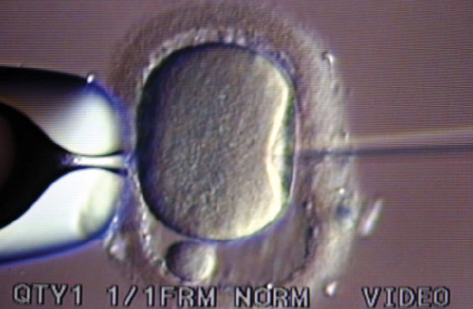 microscope image of in vitro fertilization