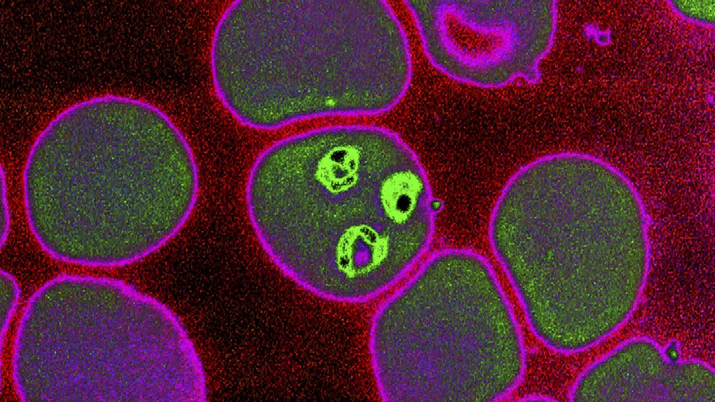 microscope image of Plasmodium falciparum parasites