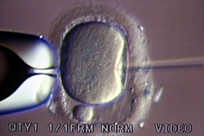 magnified image of a needle injecting sperm into an egg