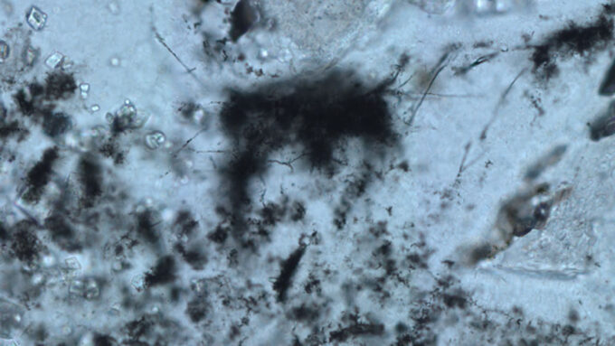 microscope image of archaea