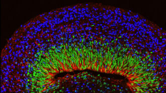 3-D brain organoids grown in the lab