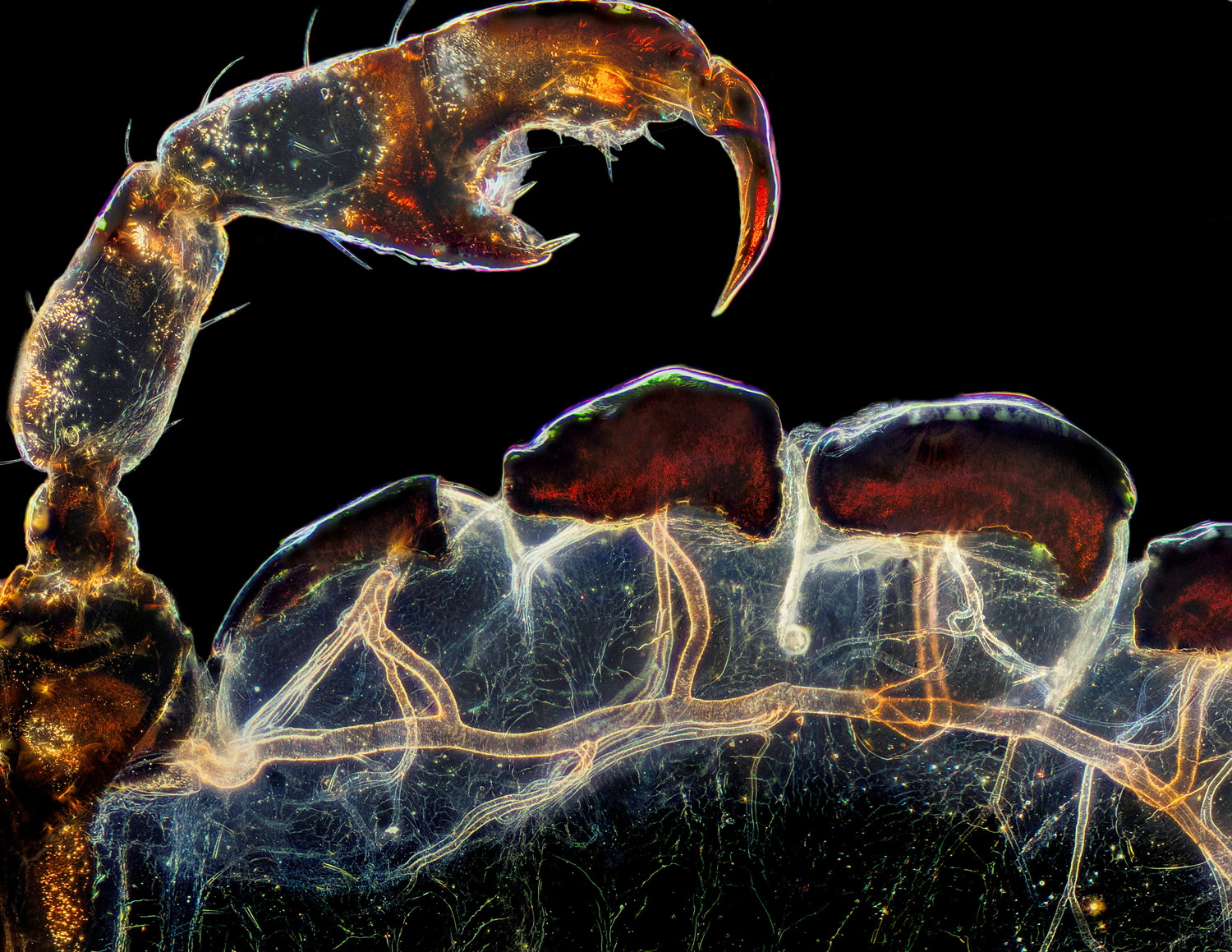 a microscopic close-up of a hog louse's claw