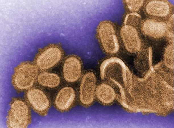 1918 flu under microscope