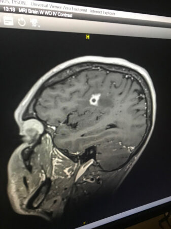 bottenus brain scan