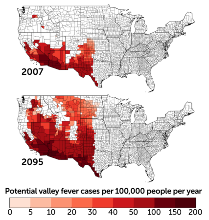 Valley fever