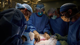 several doctors in scrubs and masks look at a patient on an operating table