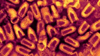 an electron micrograph showing the rabies virus