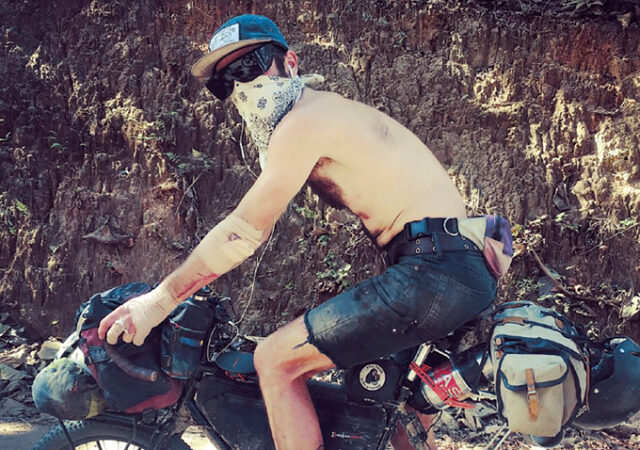 image of Tyson Bottenus on a bike wearing a bandage on his arm