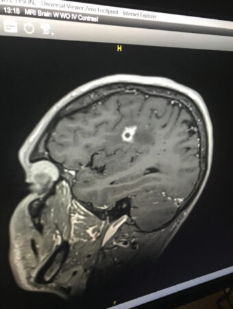 black and white brain scan
