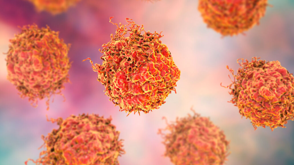illustration of orange and red prostate cancer cells