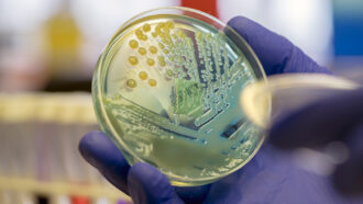 a culture dish showing Klebsiella pneumoniae bacteria
