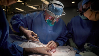doctors performing a pig-to-human kidney transplant surgery