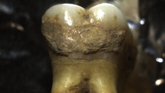 image of an ancient tooth covered in plaque