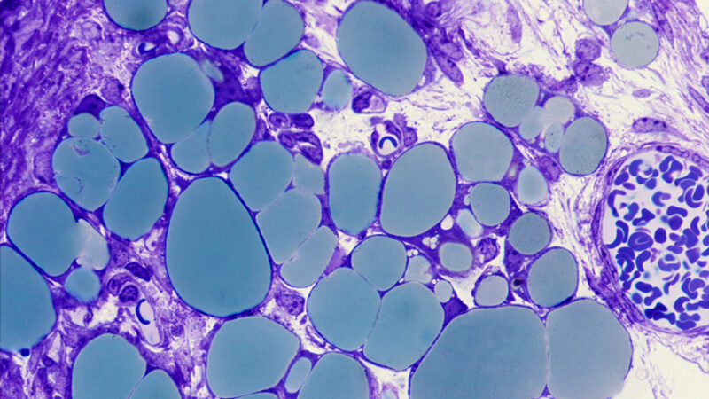 microscope image of purple-stained fat cells with masses of green lipids inside them