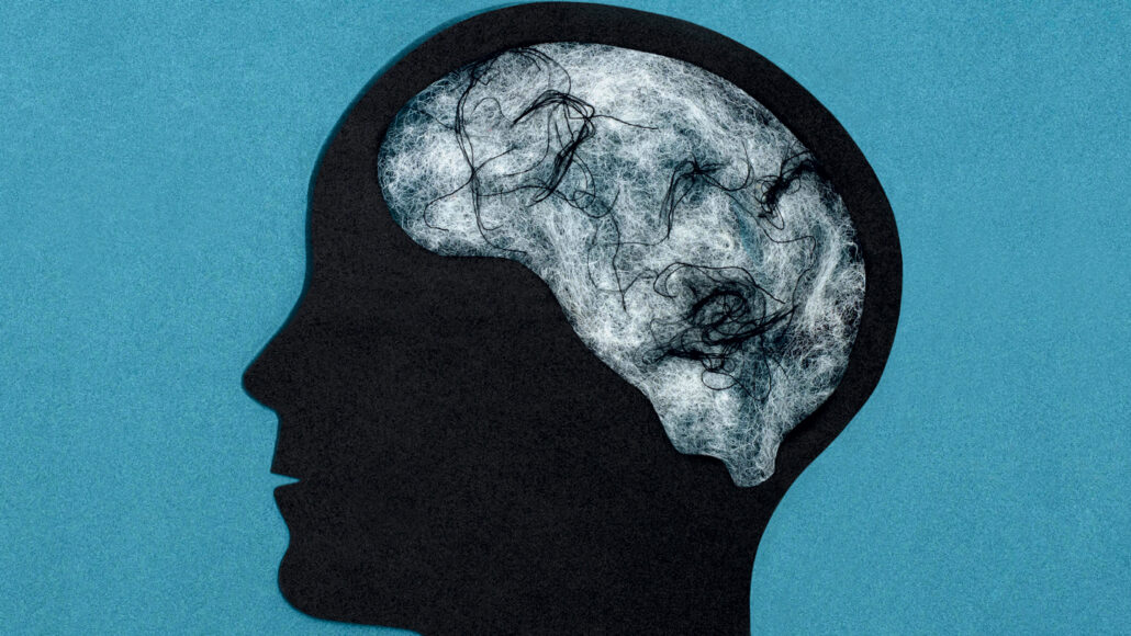 illustration of a brain inside a head silhouette