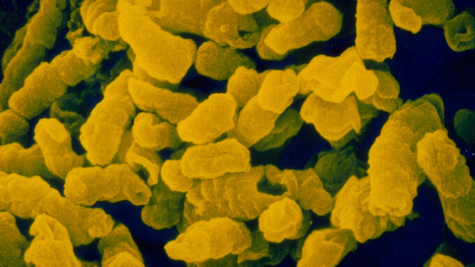 microscope image of Haemophilus influenzae type b bacteria