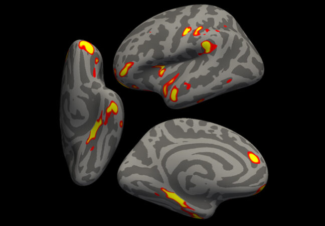 a brain shown from three different angles with regions linked to smell highlighted in yellow and red