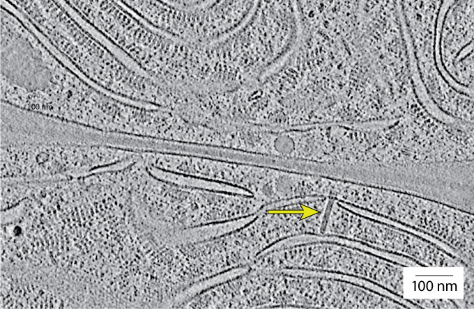 cryo-electron microscopy image of a molecular injection system inside a cell