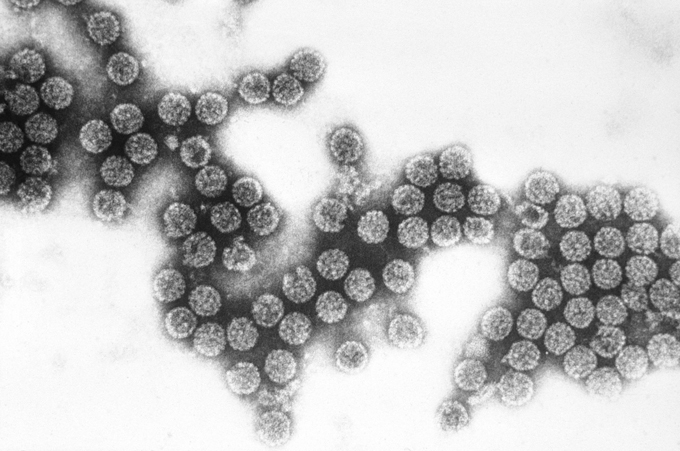 microscope image of SV40 virus particles