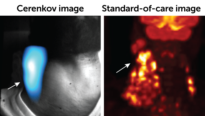 a Cerenkov luminescence image of an individual's neck next to a PET/CT scan, which is the standard-of-care image