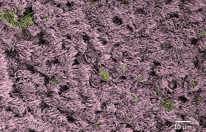 healthy human airway cells with mucus, shown in colorized electron micrograph