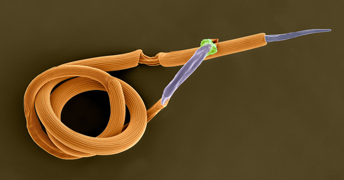 SEM image of a brown stomach worm (Teladorsagia circumcincta)