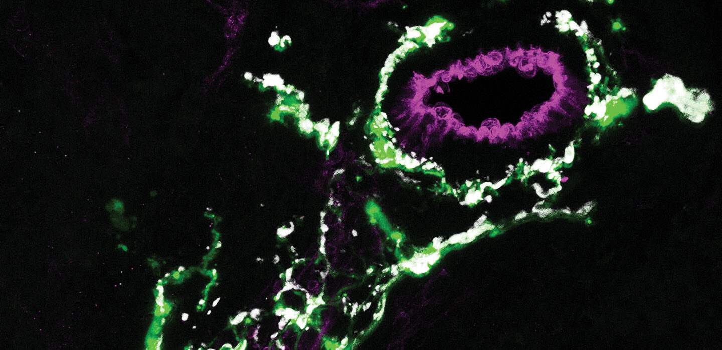 Glia cell in mouse spleen