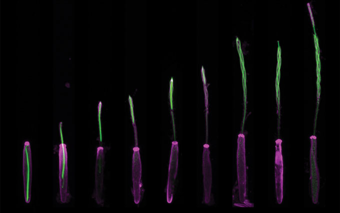 Fluorescence microscopy image of a sea anemone stinger extending during the sting process