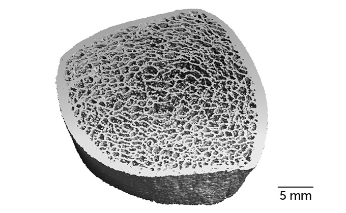 CT scan image of the interior structure of an astronaut's shin bone