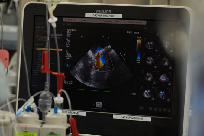 photo of an echocardiogram machine showing a pig heart beating after transplant