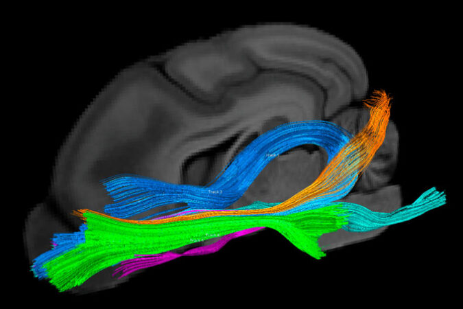 diagram showing the inside of a dog brain